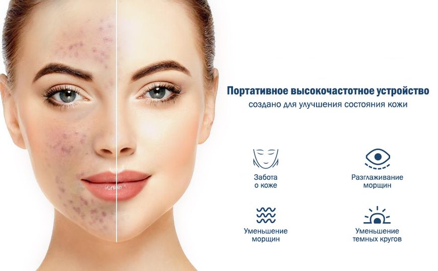 Портативна Дарсонваль Medica+ Darsoline 7.0 (MD-102969) 470789 фото